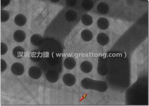 BGA因?yàn)楹笁|變小，造成錫膏過多而最終形成焊接短路的結(jié)果。